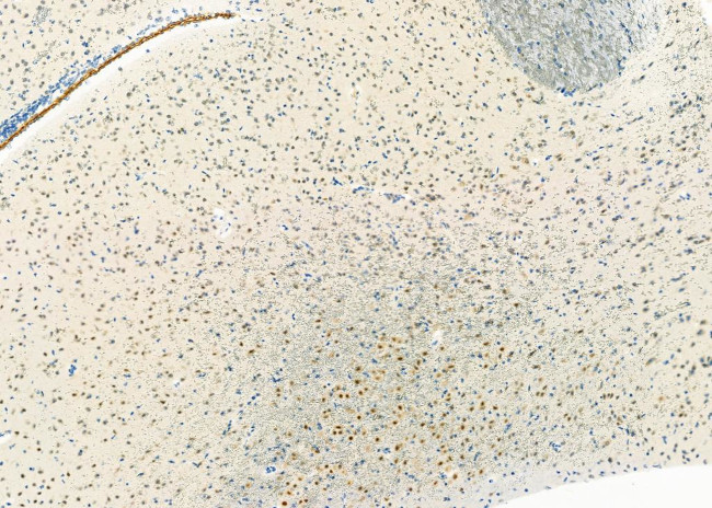 ADARB1 Antibody in Immunohistochemistry (Paraffin) (IHC (P))