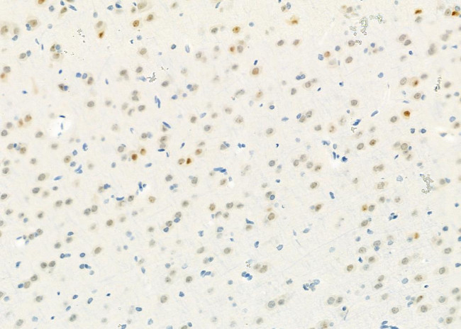 ADARB1 Antibody in Immunohistochemistry (Paraffin) (IHC (P))