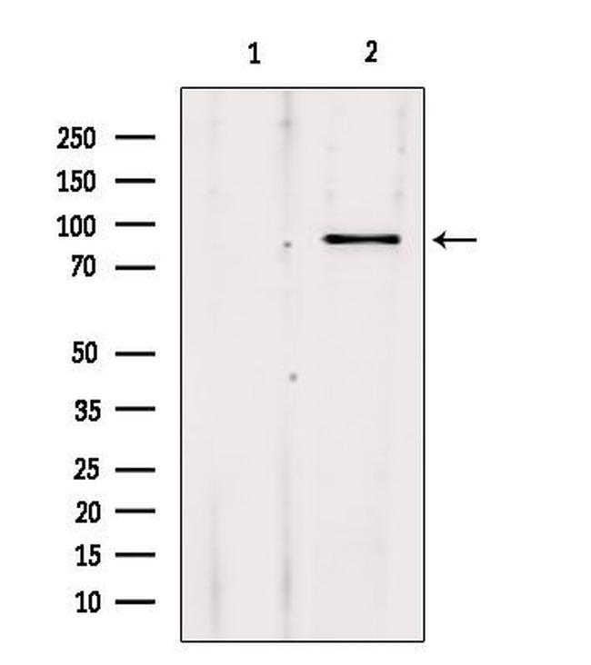 ADARB1 Antibody in Western Blot (WB)