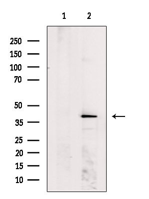 MVK Antibody in Western Blot (WB)