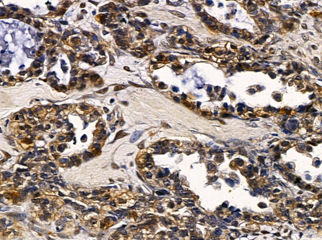 SRY Antibody in Immunohistochemistry (Paraffin) (IHC (P))