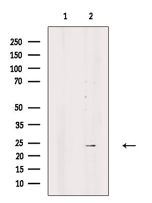 SRY Antibody in Western Blot (WB)