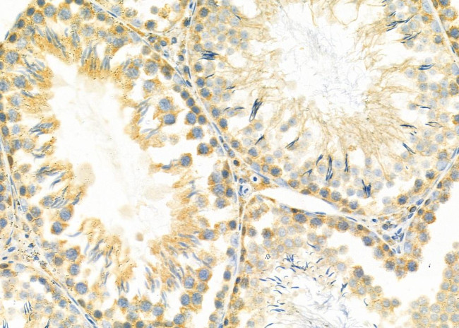 ELAVL2 Antibody in Immunohistochemistry (Paraffin) (IHC (P))