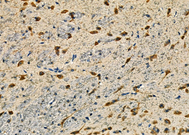 TCOF1 Antibody in Immunohistochemistry (Paraffin) (IHC (P))