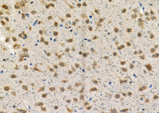 TCOF1 Antibody in Immunohistochemistry (Paraffin) (IHC (P))