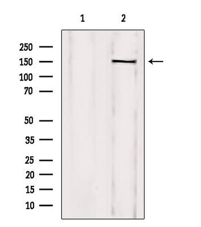 TCOF1 Antibody in Western Blot (WB)