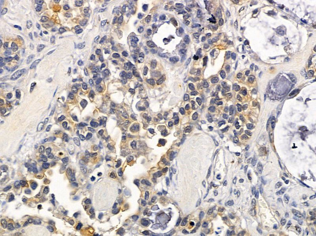 TNFAIP1 Antibody in Immunohistochemistry (Paraffin) (IHC (P))