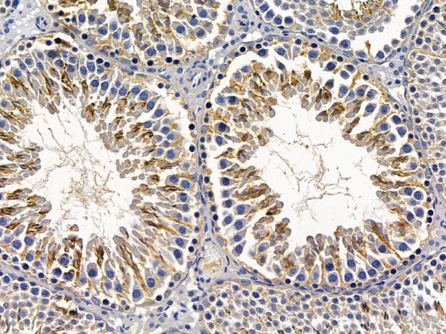 TNFAIP1 Antibody in Immunohistochemistry (Paraffin) (IHC (P))