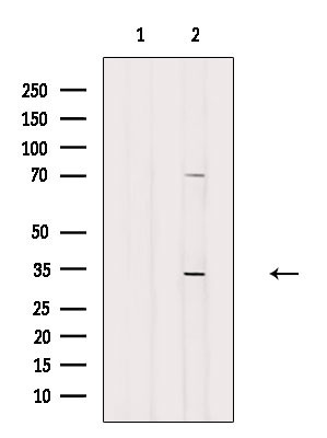 TNFAIP1 Antibody in Western Blot (WB)