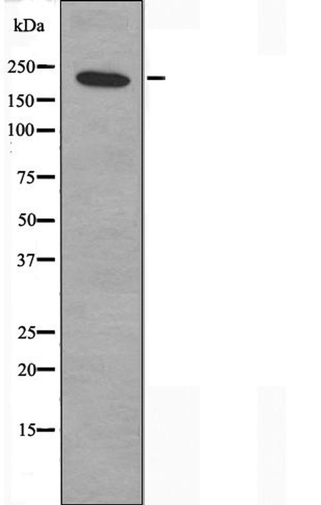 ZNF638 Antibody in Western Blot (WB)