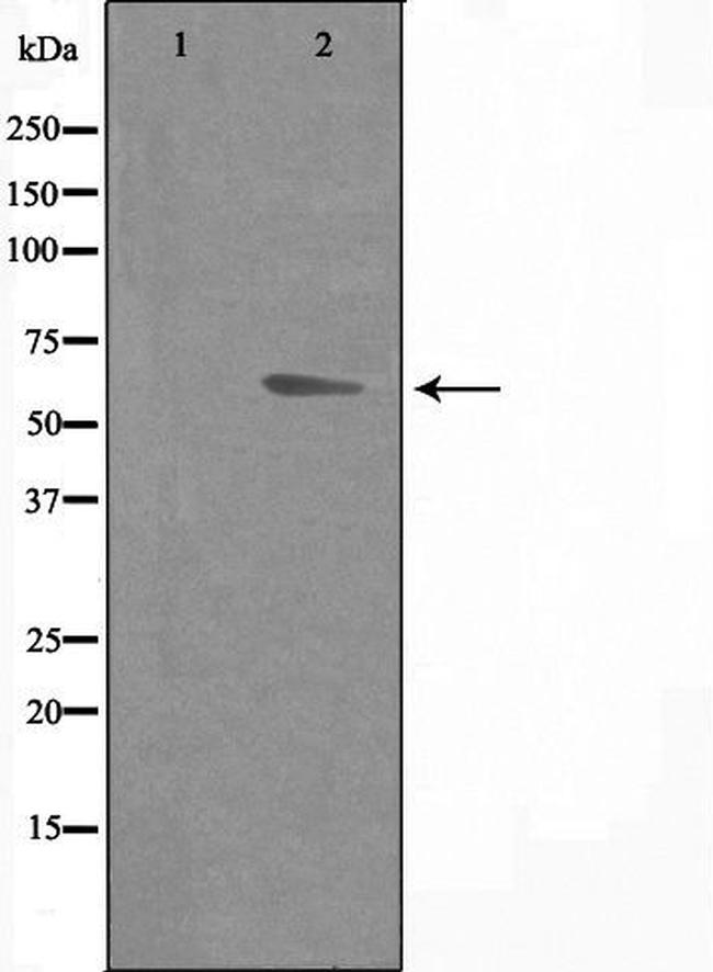 DOK7 Antibody in Western Blot (WB)