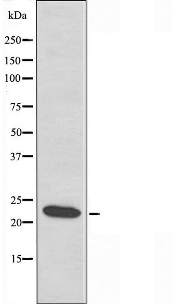 LDOC1L Antibody in Western Blot (WB)