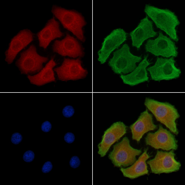 ADCK2 Antibody in Immunocytochemistry (ICC/IF)