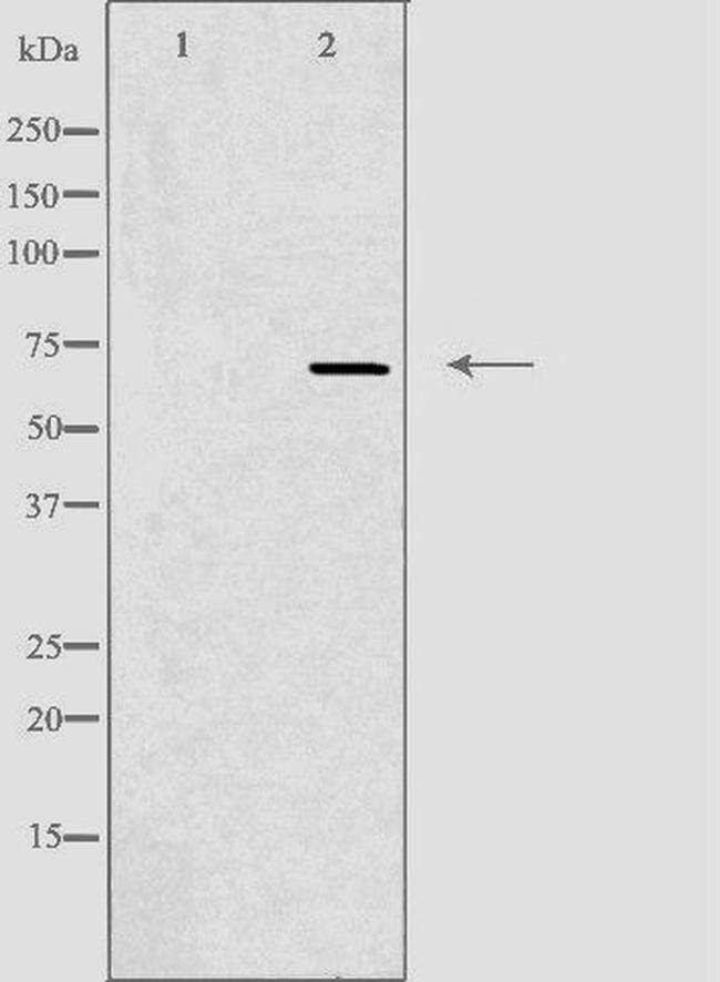 ADCK2 Antibody in Western Blot (WB)