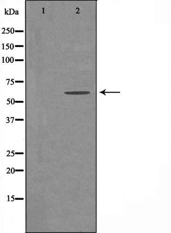 ADCK1 Antibody in Western Blot (WB)