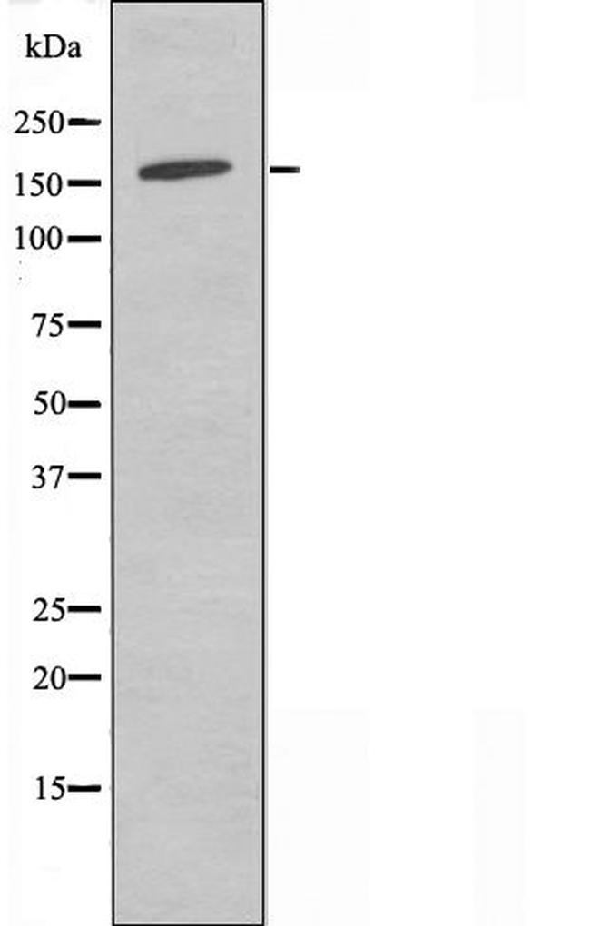 MAGI2 Antibody in Western Blot (WB)