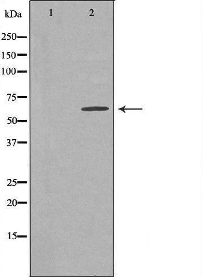 TBC1D3C Antibody in Western Blot (WB)