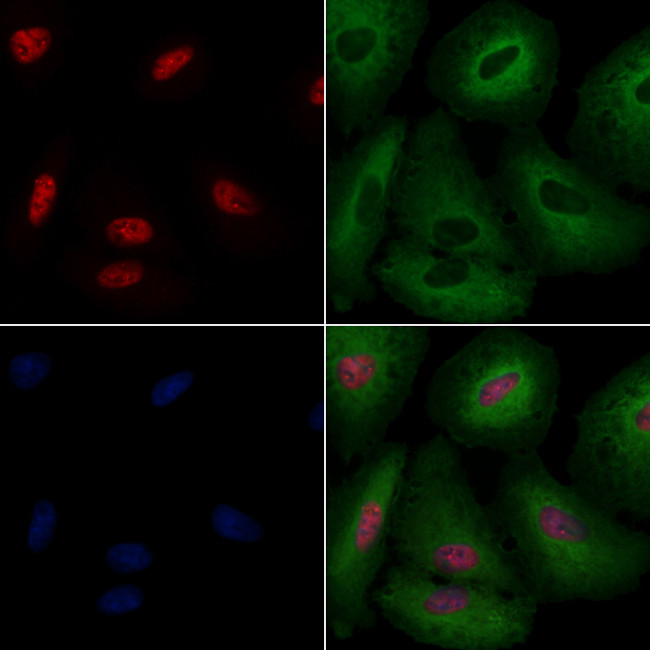 DBC1 Antibody in Immunocytochemistry (ICC/IF)