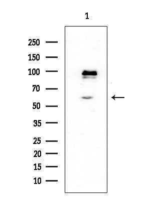 DBC1 Antibody in Western Blot (WB)