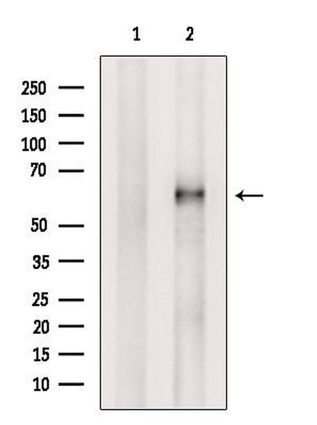 ACRBP Antibody in Western Blot (WB)