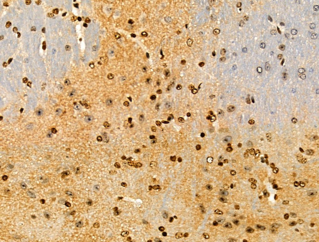 PPP1R14C Antibody in Immunohistochemistry (Paraffin) (IHC (P))