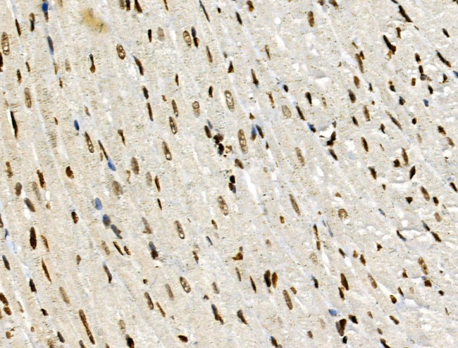 PPP1R14C Antibody in Immunohistochemistry (Paraffin) (IHC (P))