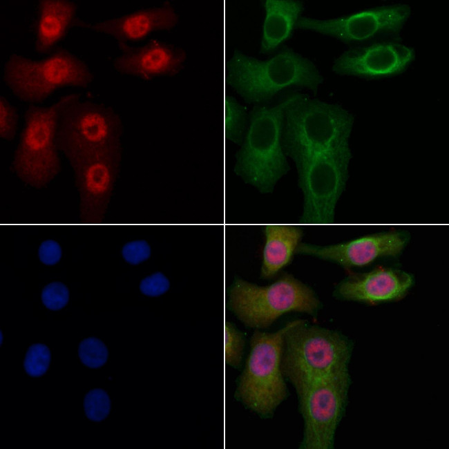 SMARCC2 Antibody in Immunocytochemistry (ICC/IF)