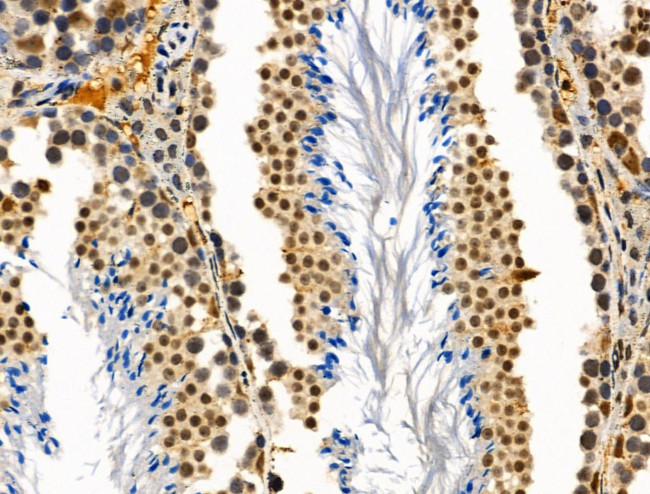 SMARCC2 Antibody in Immunohistochemistry (Paraffin) (IHC (P))