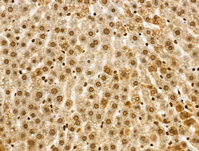 SMARCC2 Antibody in Immunohistochemistry (Paraffin) (IHC (P))