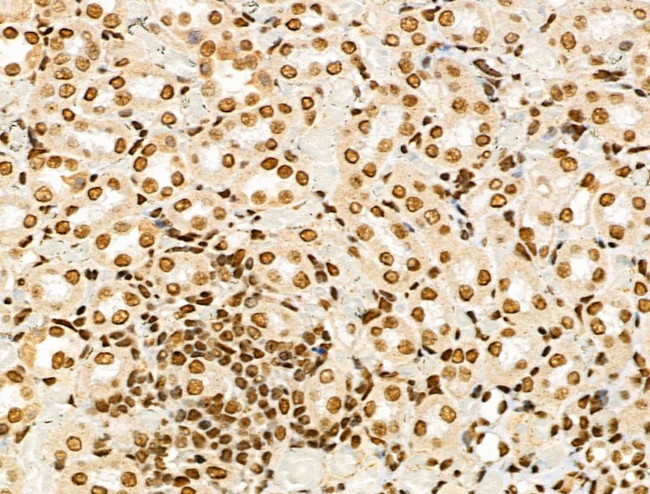 SMARCC2 Antibody in Immunohistochemistry (Paraffin) (IHC (P))