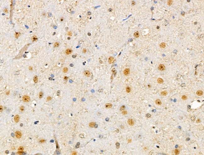 SMARCC2 Antibody in Immunohistochemistry (Paraffin) (IHC (P))