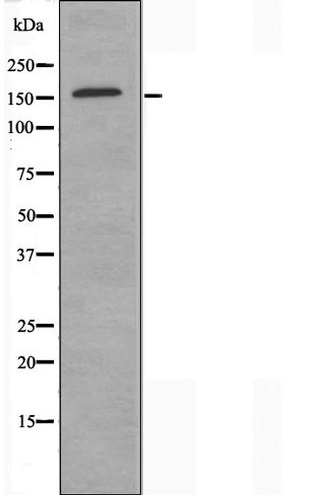 SMARCC2 Antibody in Western Blot (WB)