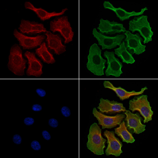 GRK7 Antibody in Immunocytochemistry (ICC/IF)