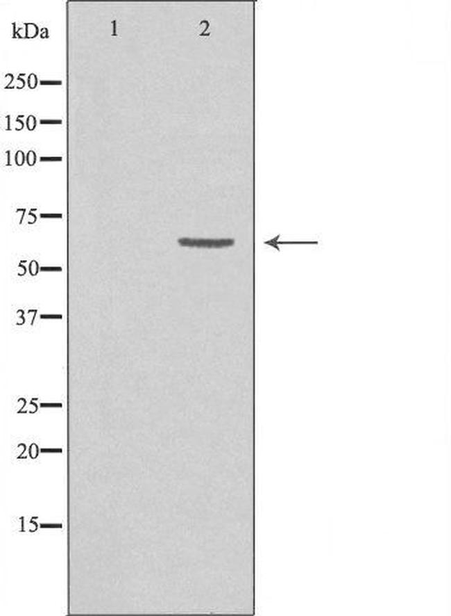 GRK7 Antibody in Western Blot (WB)