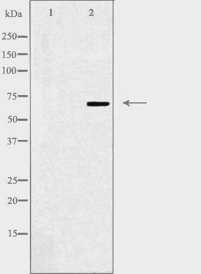 ZNF668 Antibody in Western Blot (WB)