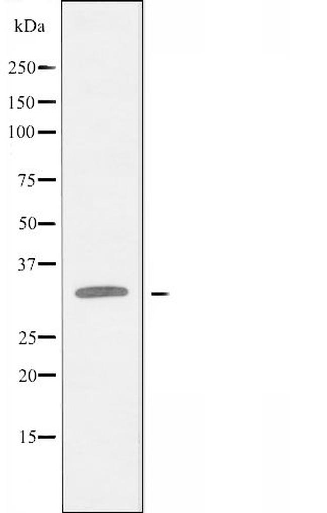 C1orf35 Antibody in Western Blot (WB)