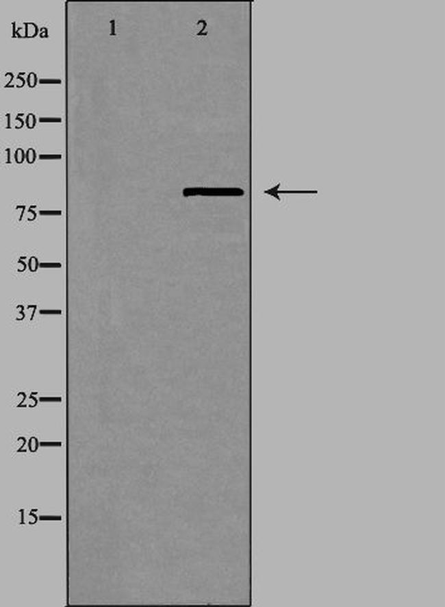 UTP14A Antibody in Western Blot (WB)