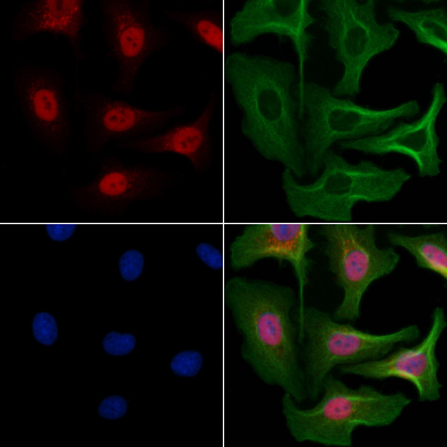 NY-BR-1 Antibody in Immunocytochemistry (ICC/IF)