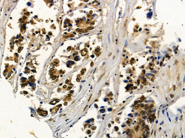 NY-BR-1 Antibody in Immunohistochemistry (Paraffin) (IHC (P))