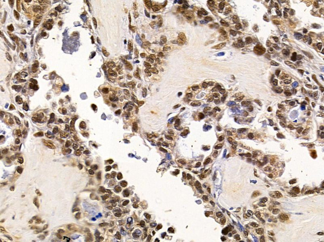 NY-BR-1 Antibody in Immunohistochemistry (Paraffin) (IHC (P))