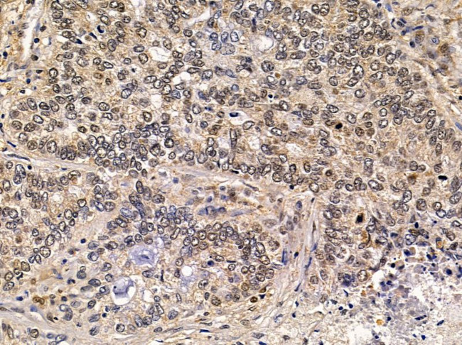 NY-BR-1 Antibody in Immunohistochemistry (Paraffin) (IHC (P))