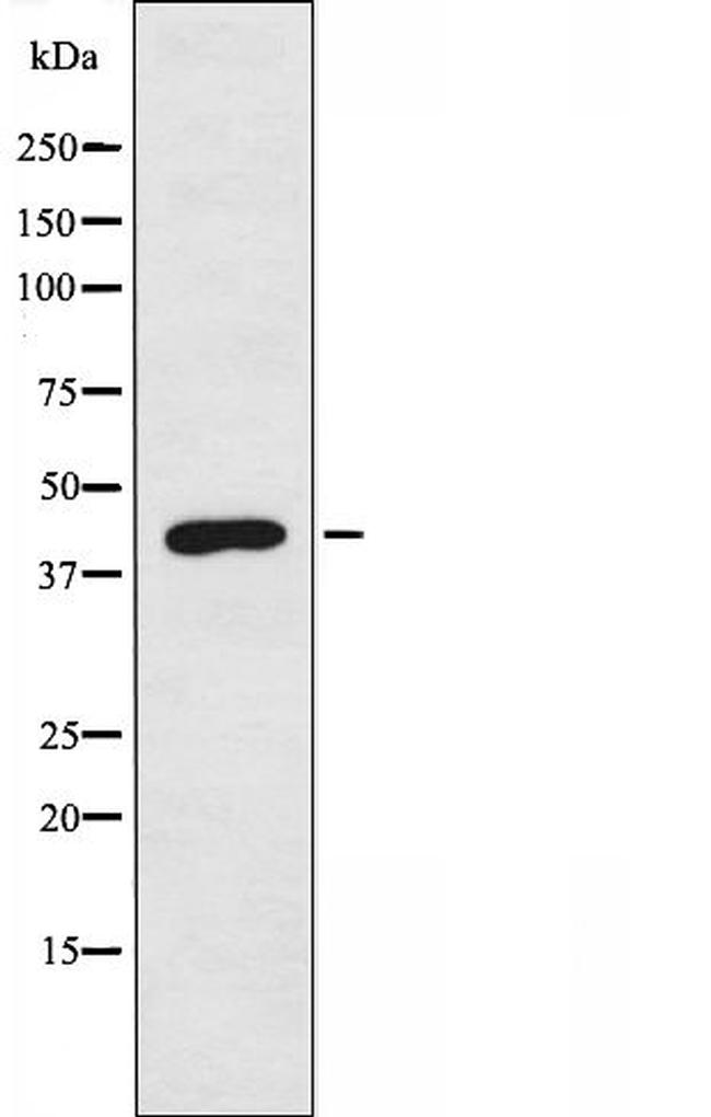 BLZF1 Antibody in Western Blot (WB)