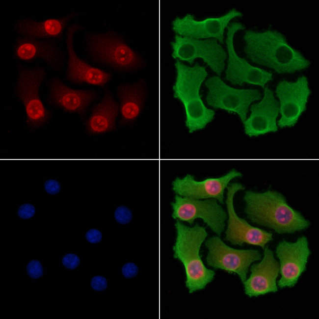 ARNT2 Antibody in Immunocytochemistry (ICC/IF)