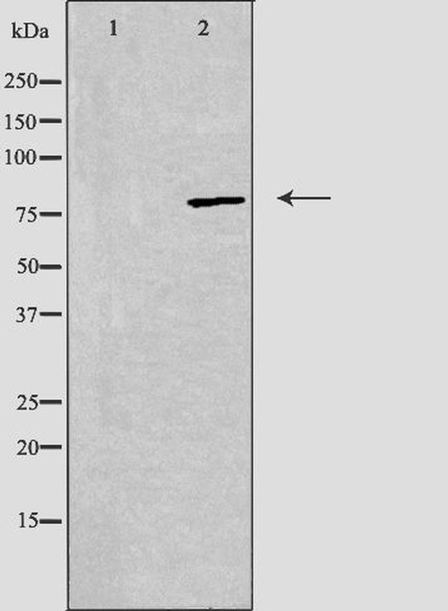 beta Adducin Antibody in Western Blot (WB)