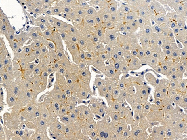 AVEN Antibody in Immunohistochemistry (Paraffin) (IHC (P))