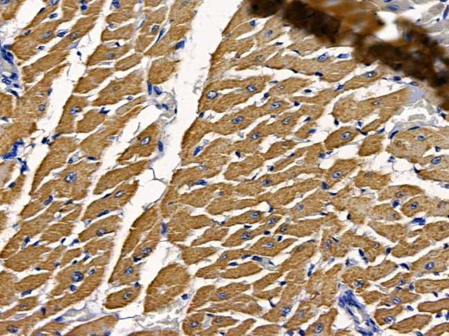 AVEN Antibody in Immunohistochemistry (Paraffin) (IHC (P))