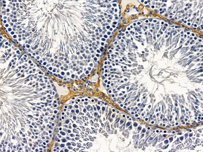 AVEN Antibody in Immunohistochemistry (Paraffin) (IHC (P))