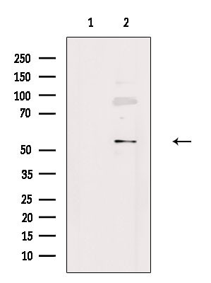 AVEN Antibody in Western Blot (WB)