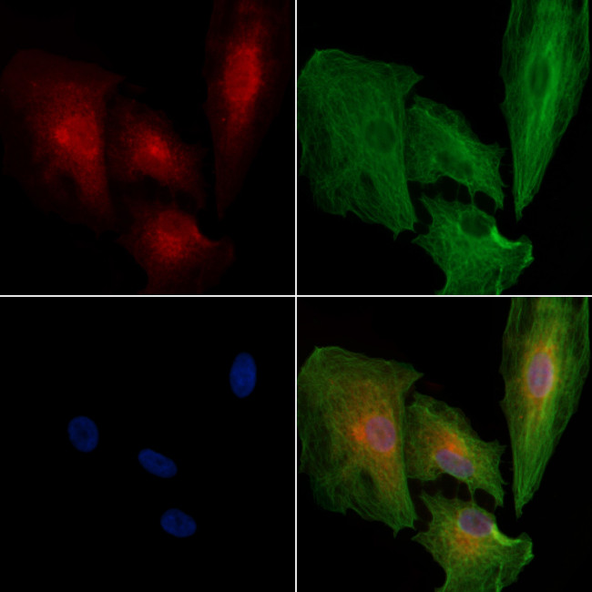 CD160 Antibody in Immunocytochemistry (ICC/IF)