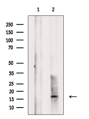 CD160 Antibody in Western Blot (WB)
